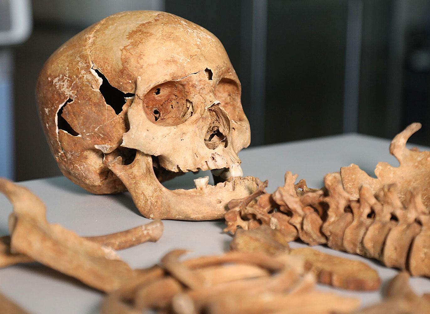 A skeleton, in pieces.